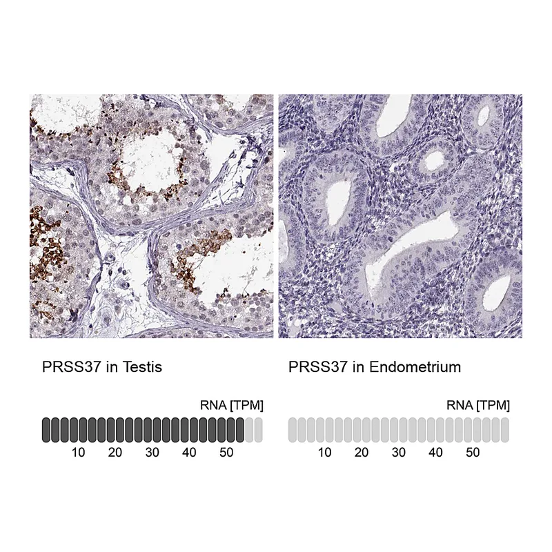 Atlas Antibodies Anti-PRSS37 Antibody