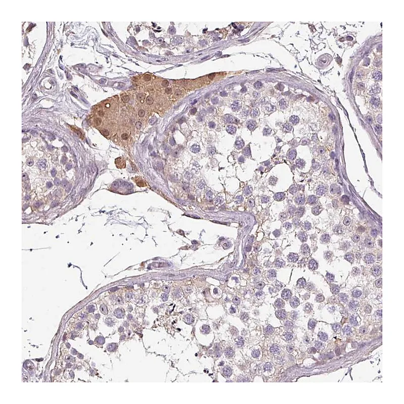 Atlas Antibodies Anti-PRSS38 Antibody
