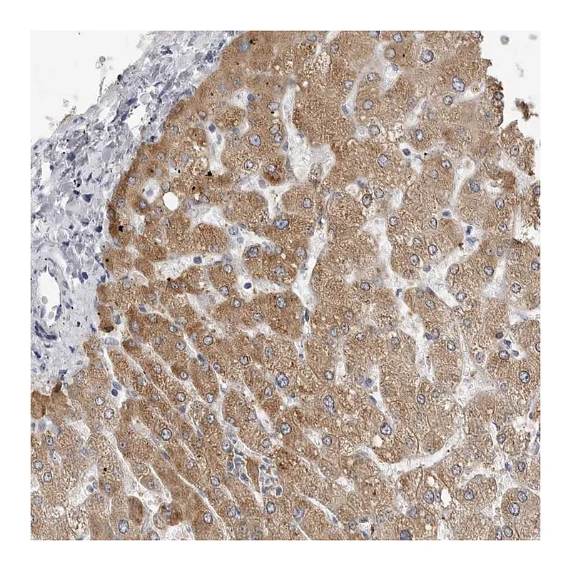 Atlas Antibodies Anti-PRSS38 Antibody
