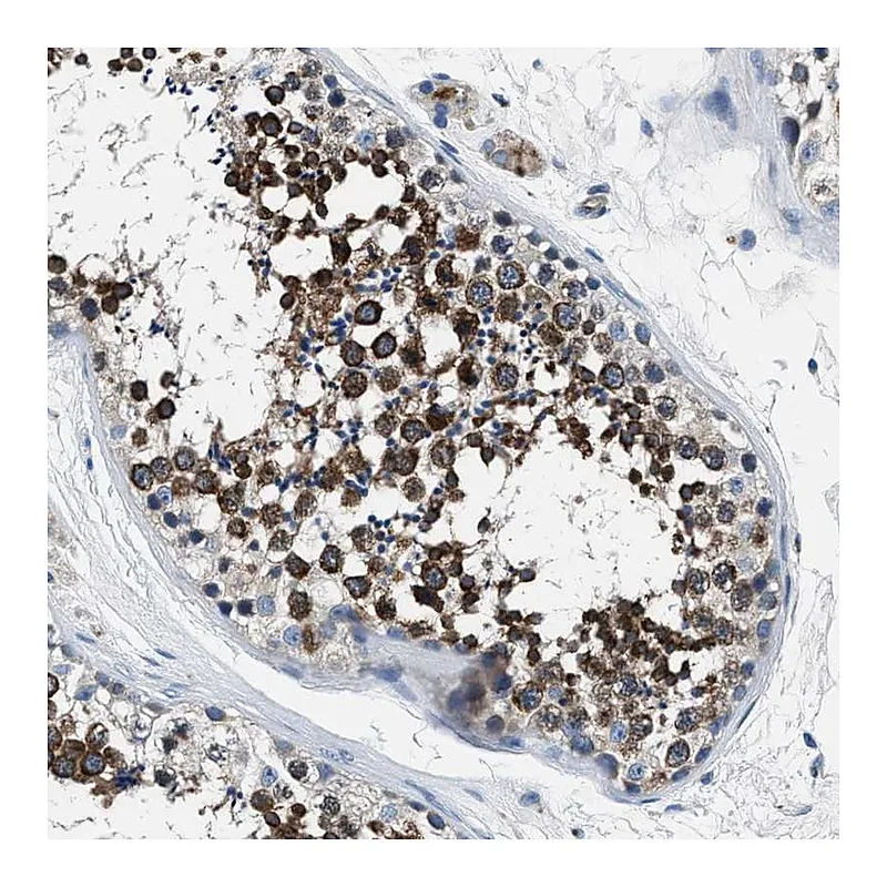 Atlas Antibodies Anti-PRTFDC1 Antibody