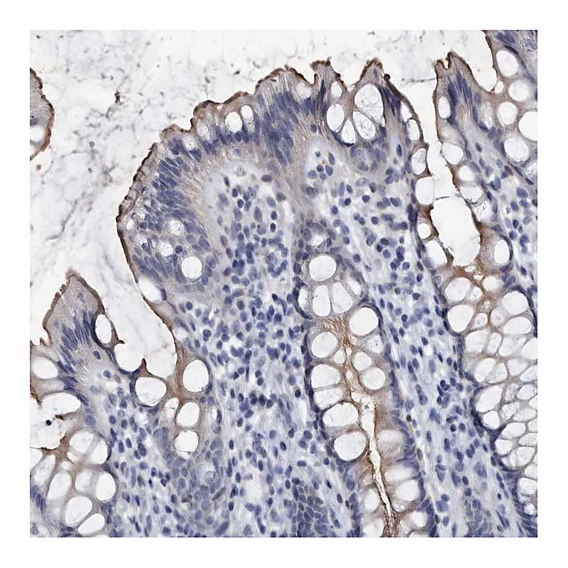 Atlas Antibodies Anti-PRSS8 Antibody