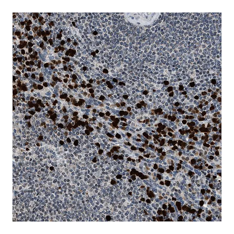 Atlas Antibodies Anti-PRUNE2 Antibody