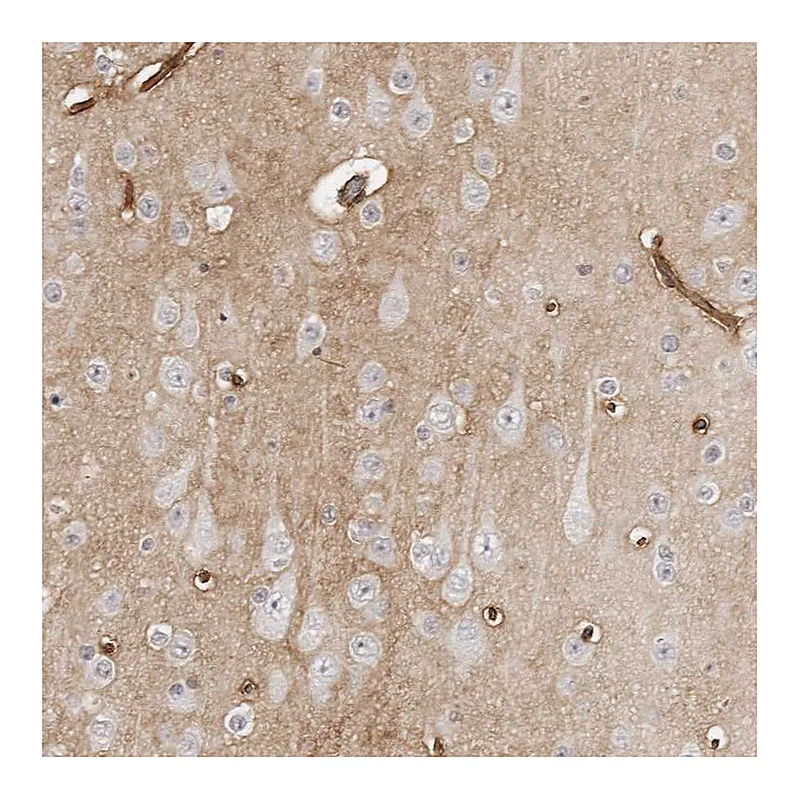 Atlas Antibodies Anti-PRUNE1 Antibody