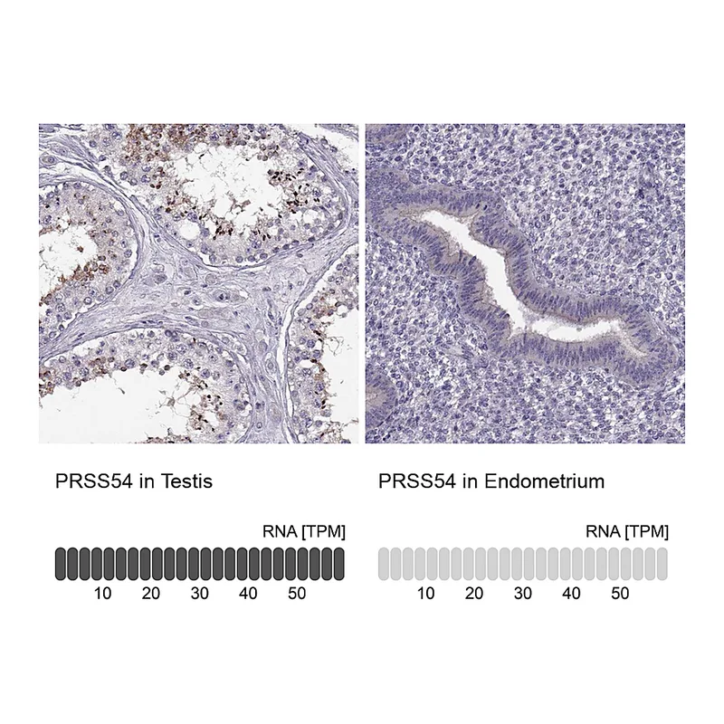 Atlas Antibodies Anti-PRSS54 Antibody