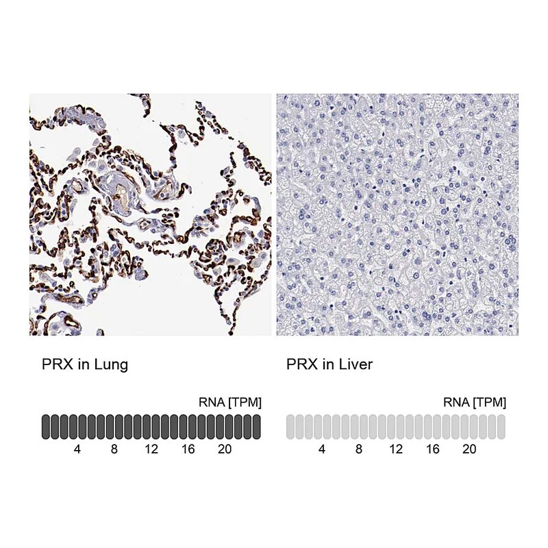 Atlas Antibodies Anti-PRX Antibody