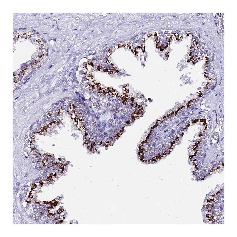 Atlas Antibodies Anti-PRY Antibody