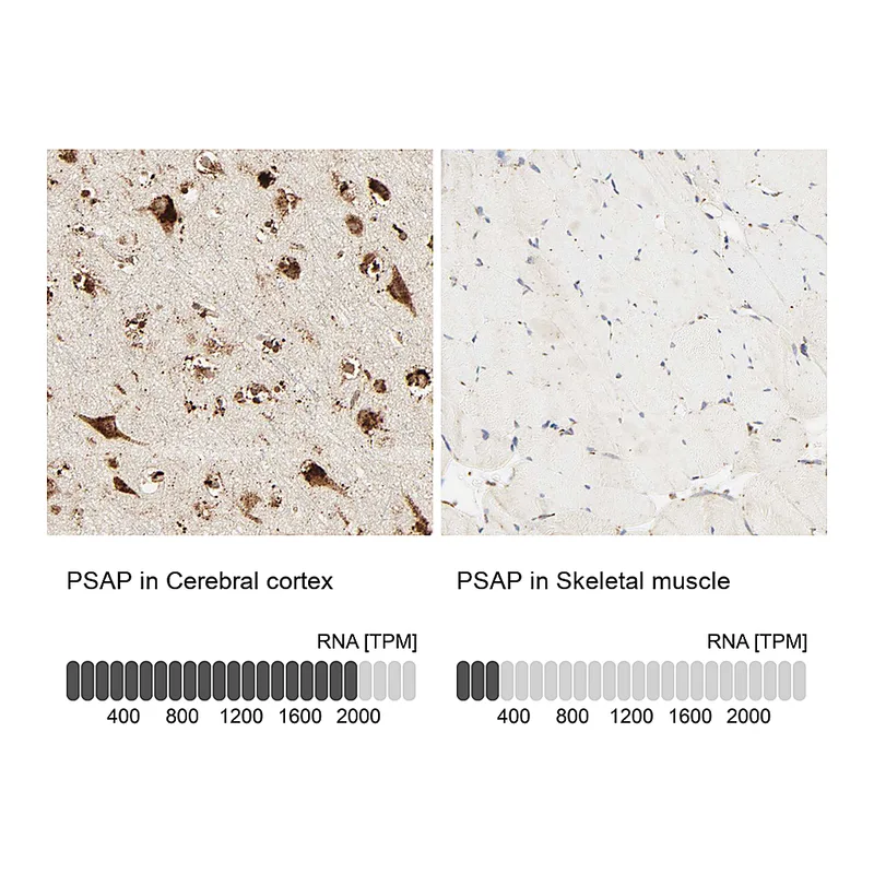 Atlas Antibodies Anti-PSAP Antibody