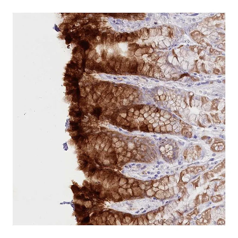 Atlas Antibodies Anti-PSAPL1 Antibody