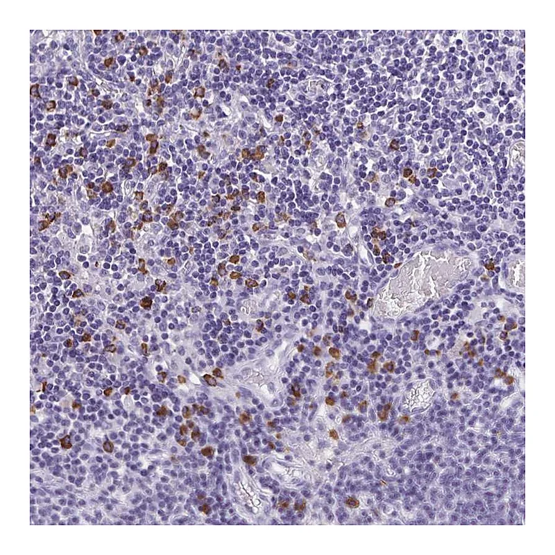 Atlas Antibodies Anti-PSD Antibody