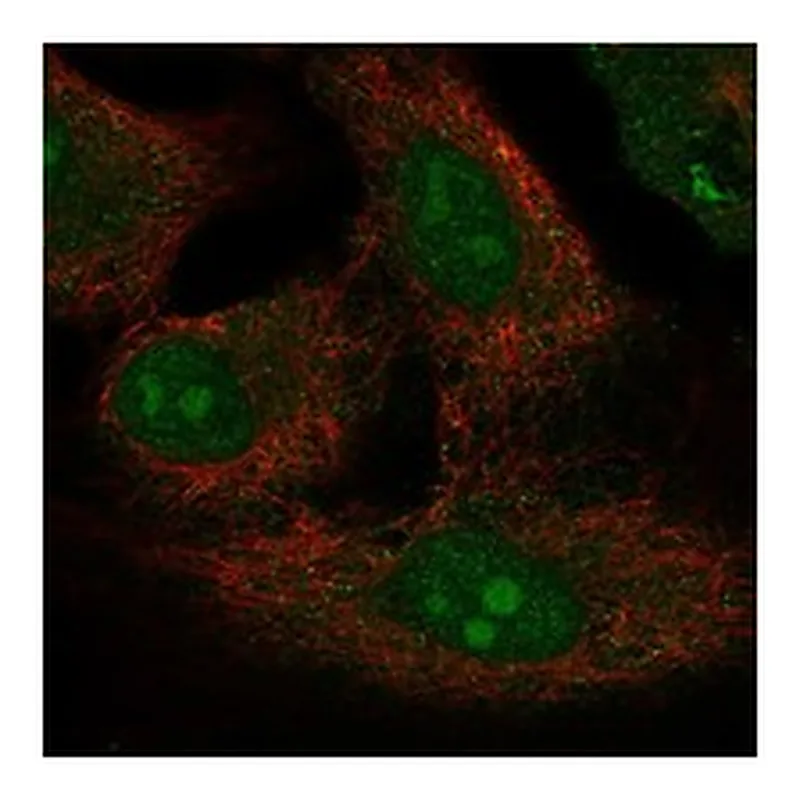 Atlas Antibodies Anti-PRY2 Antibody