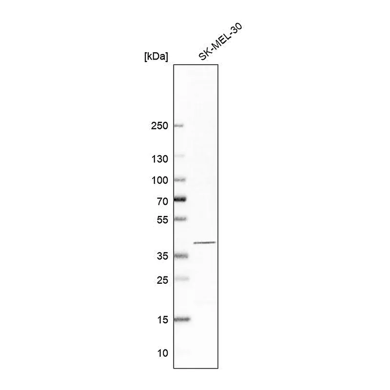 Atlas Antibodies Anti-PSAT1 Antibody