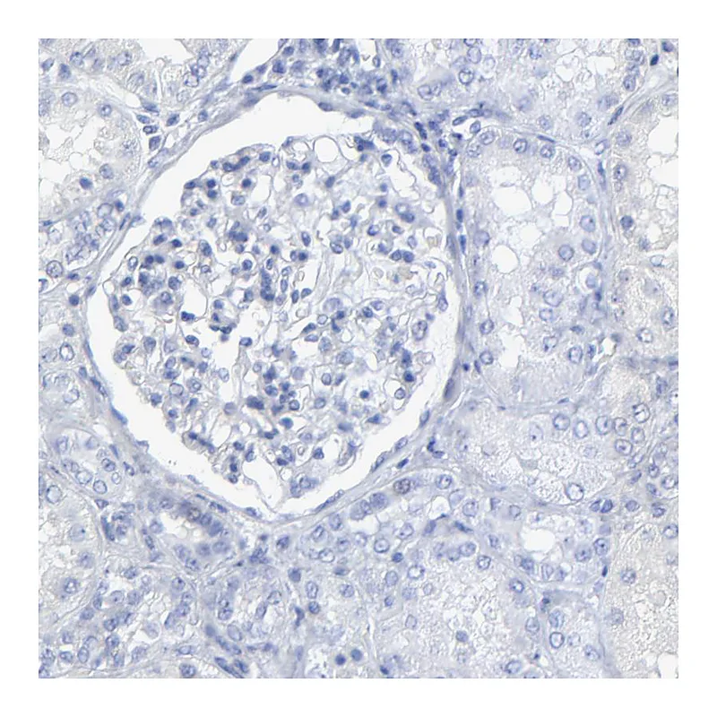 Atlas Antibodies Anti-PSD3 Antibody