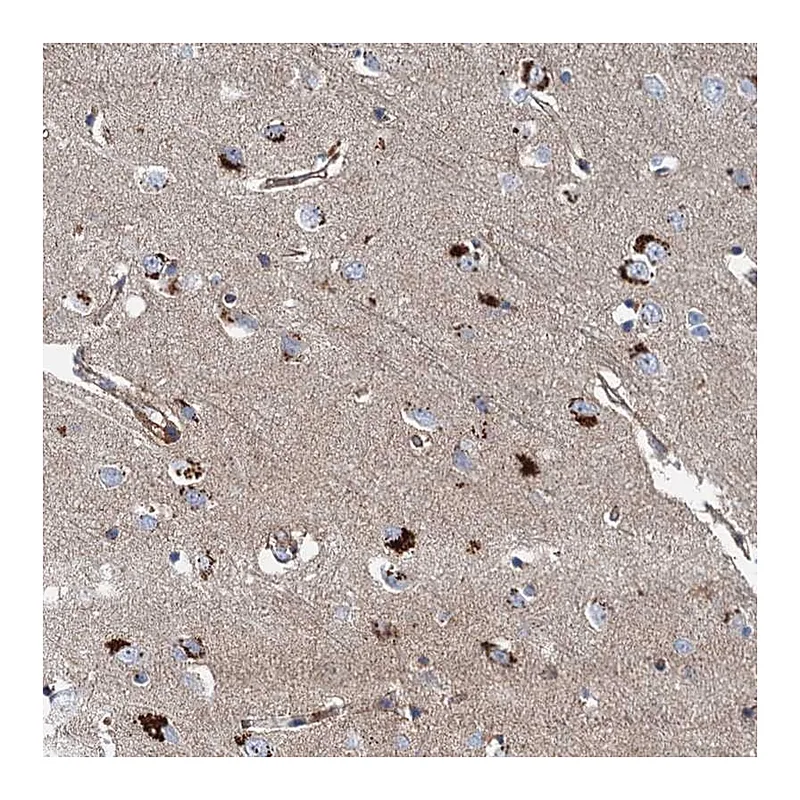 Atlas Antibodies Anti-PSEN1 Antibody