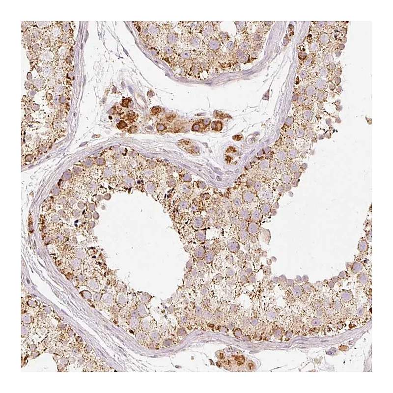 Atlas Antibodies Anti-PSENEN Antibody
