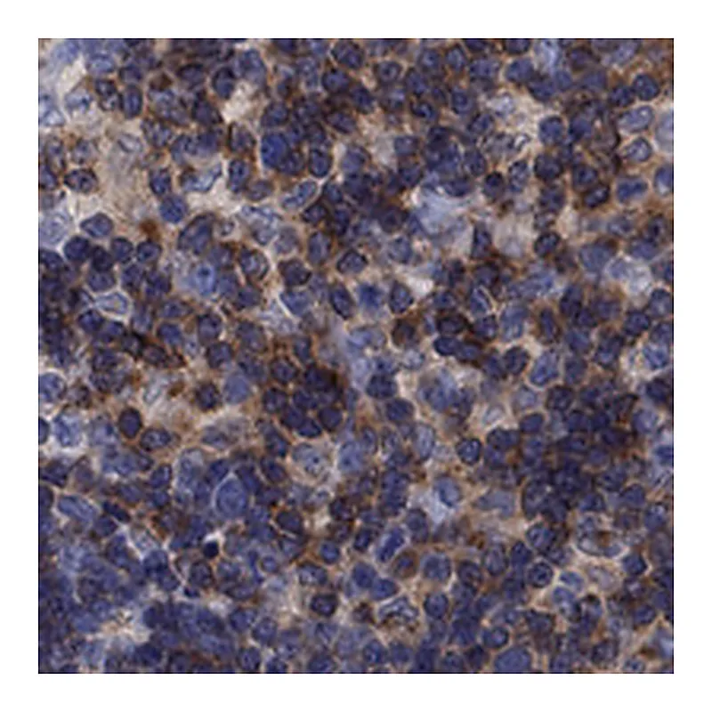 Atlas Antibodies Anti-PSD4 Antibody