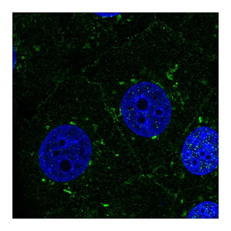 Atlas Antibodies Anti-PSEN1 Antibody