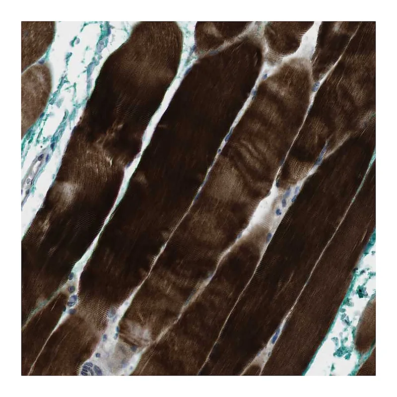 Atlas Antibodies Anti-PSKH2 Antibody