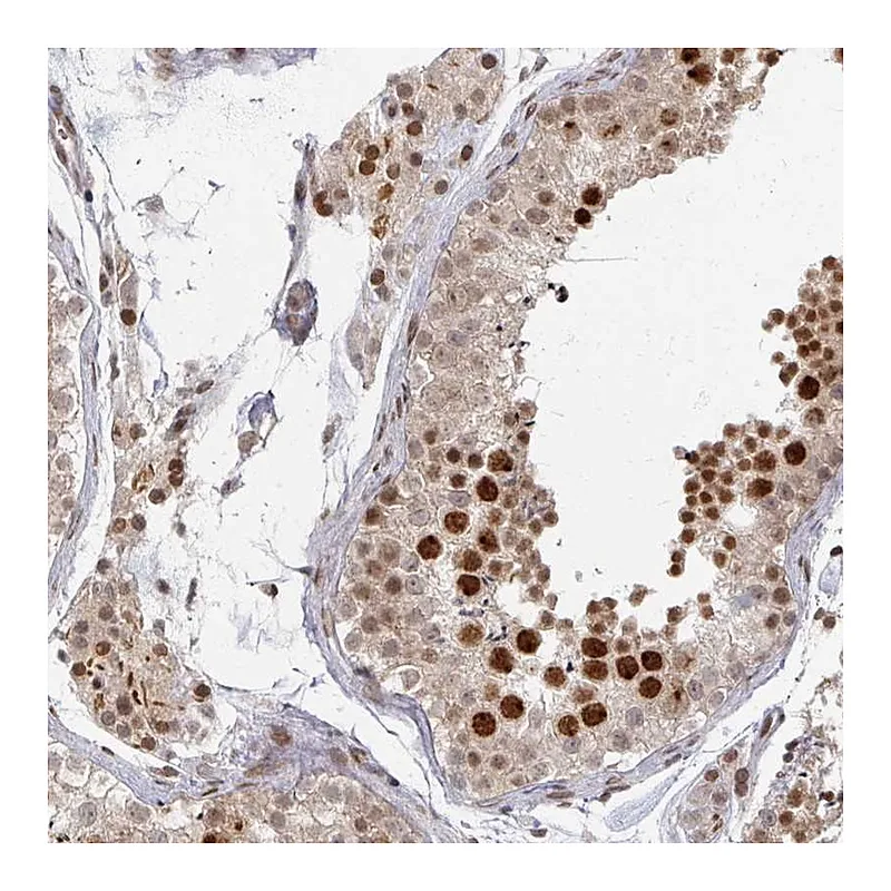Atlas Antibodies Anti-PSKH1 Antibody