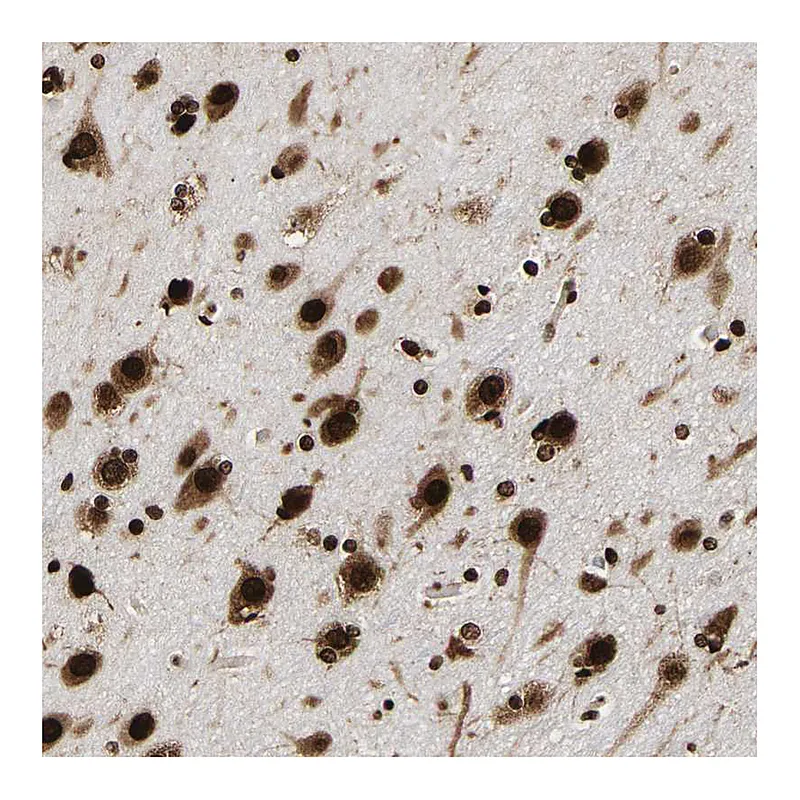 Atlas Antibodies Anti-PSIP1 Antibody