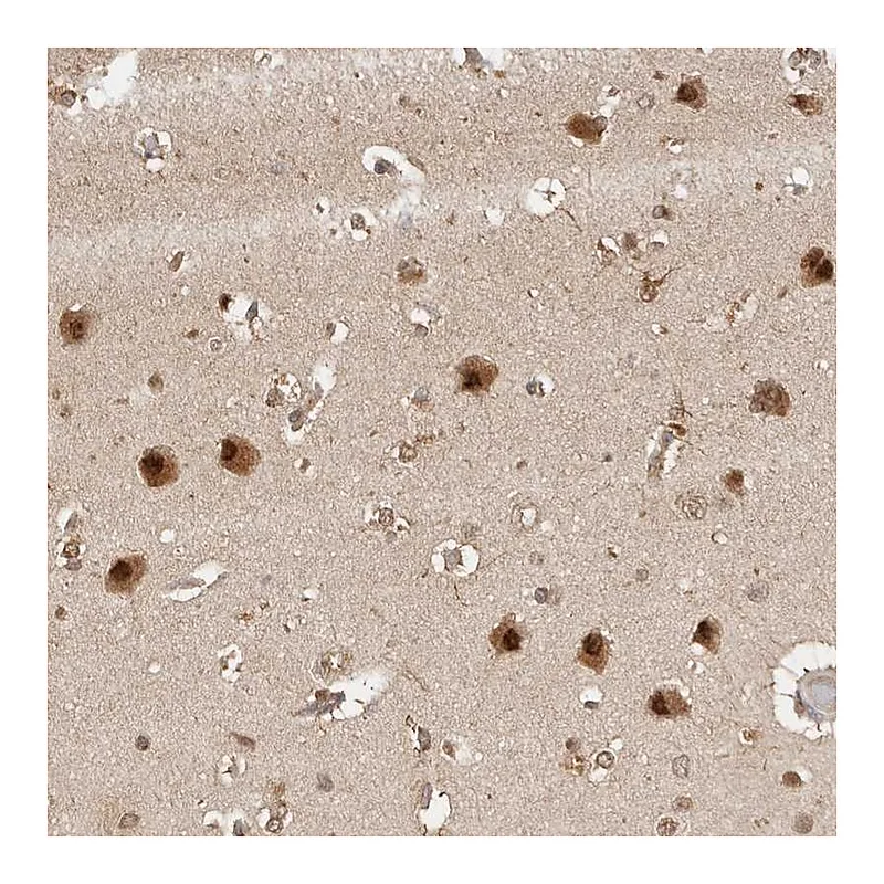 Atlas Antibodies Anti-PSMA5 Antibody