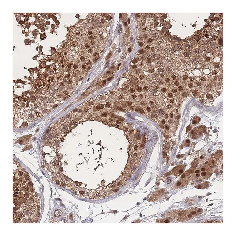 Atlas Antibodies Anti-PSMA1 Antibody