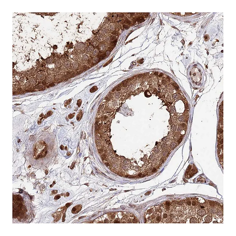 Atlas Antibodies Anti-PSMA1 Antibody