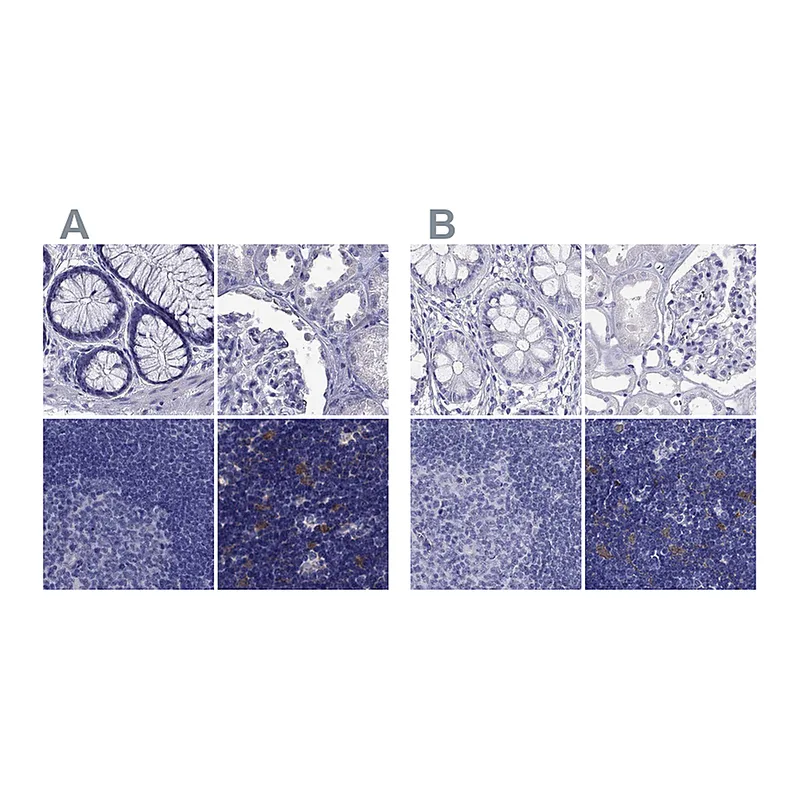 Atlas Antibodies Anti-PSMB11 Antibody
