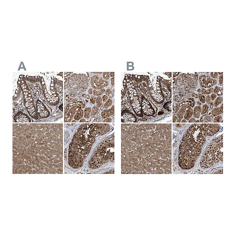Atlas Antibodies Anti-PSMB1 Antibody