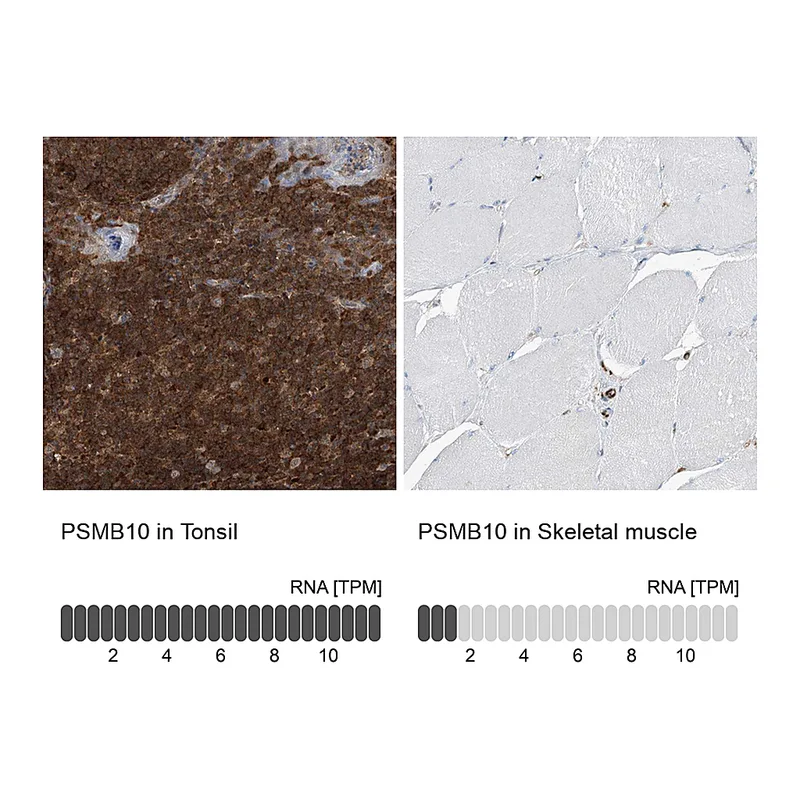 Atlas Antibodies Anti-PSMB10 Antibody