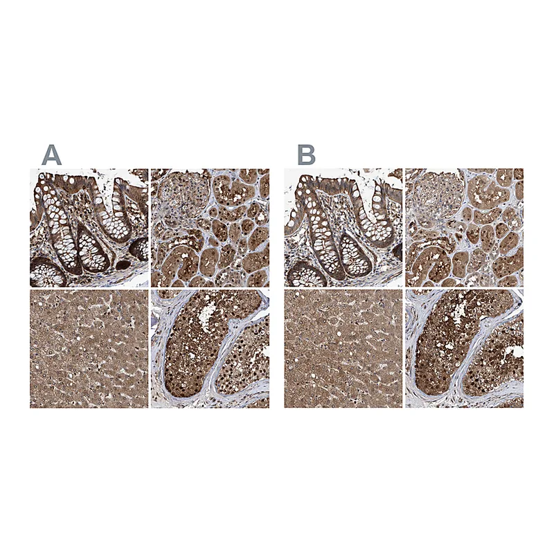 Atlas Antibodies Anti-PSMB1 Antibody