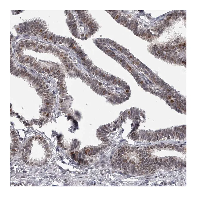 Atlas Antibodies Anti-PSMB2 Antibody