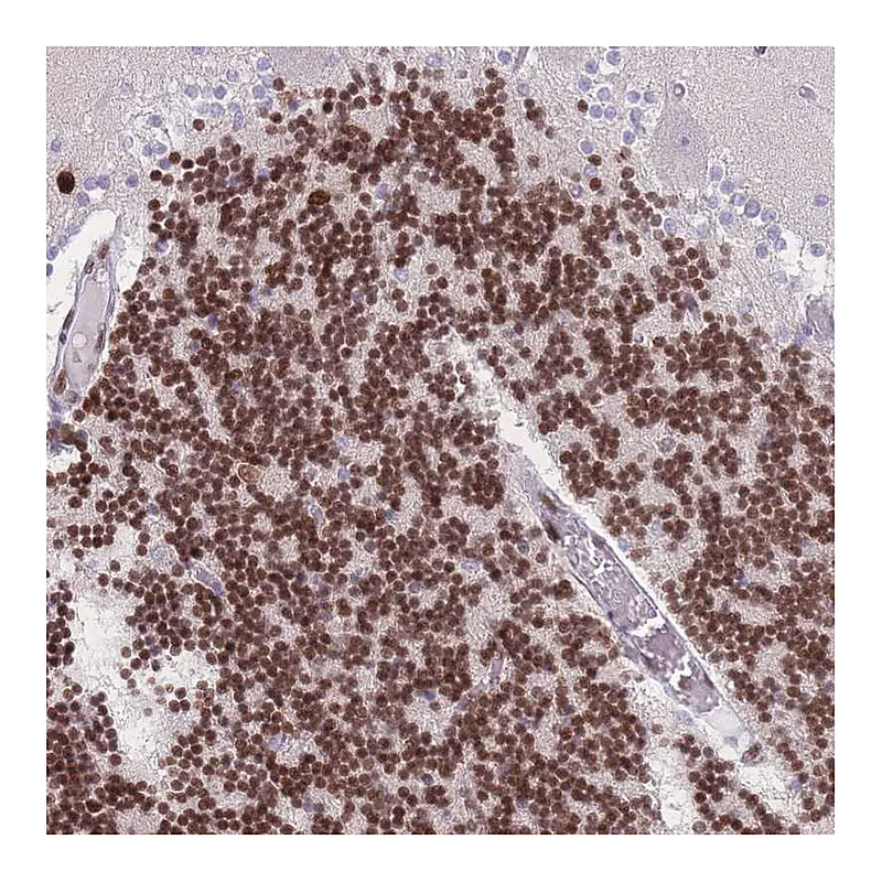 Atlas Antibodies Anti-PSMB5 Antibody