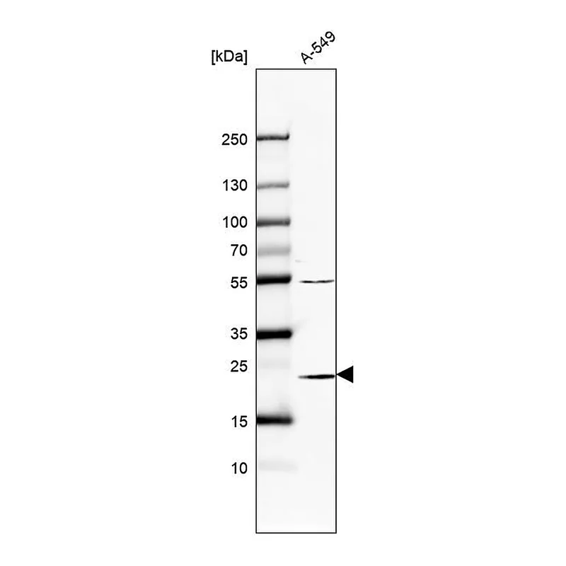 Atlas Antibodies Anti-PSMB6 Antibody