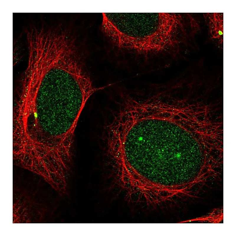 Atlas Antibodies Anti-PSMB5 Antibody