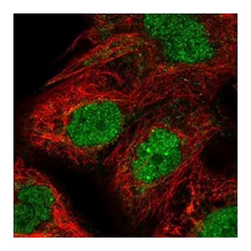Atlas Antibodies Anti-PSMB4 Antibody
