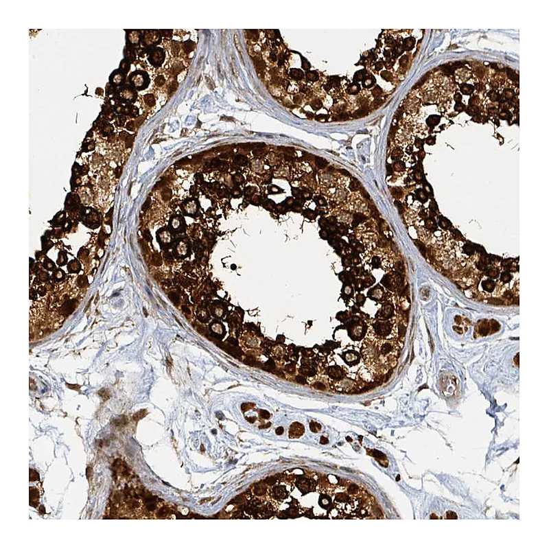 Atlas Antibodies Anti-PSMB7 Antibody