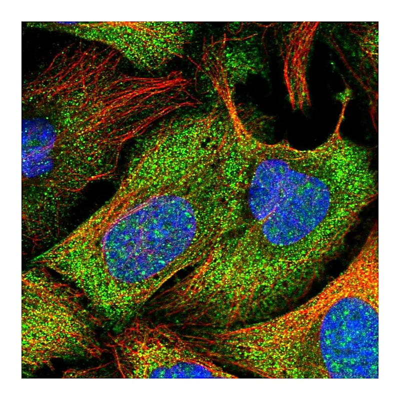Atlas Antibodies Anti-PSMB9 Antibody
