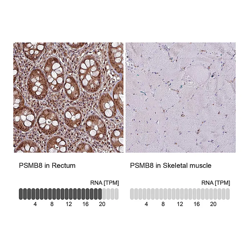 Atlas Antibodies Anti-PSMB8 Antibody
