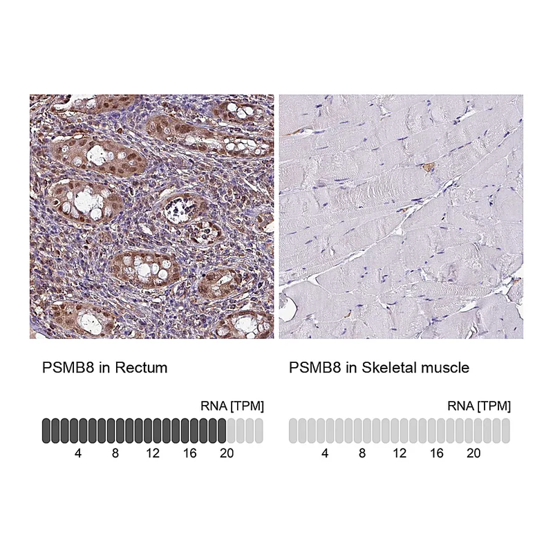 Atlas Antibodies Anti-PSMB8 Antibody