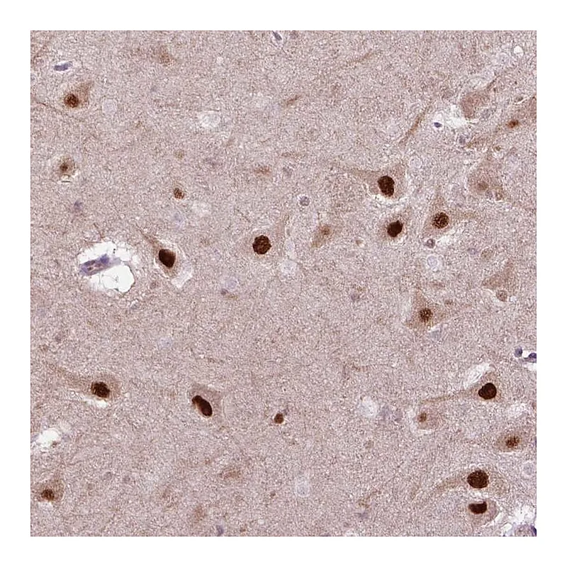 Atlas Antibodies Anti-PSMC2 Antibody