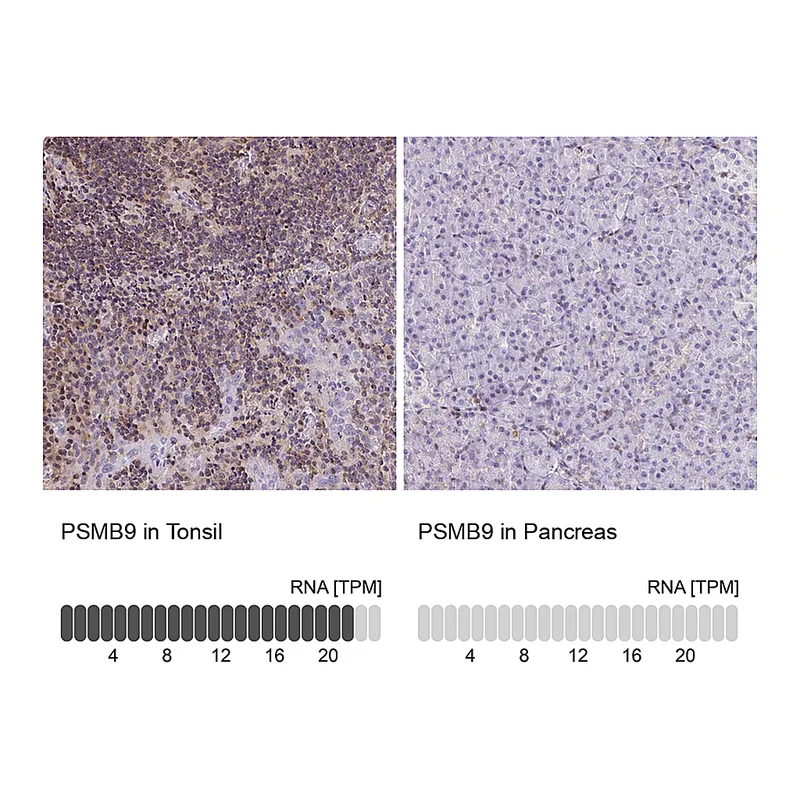 Atlas Antibodies Anti-PSMB9 Antibody