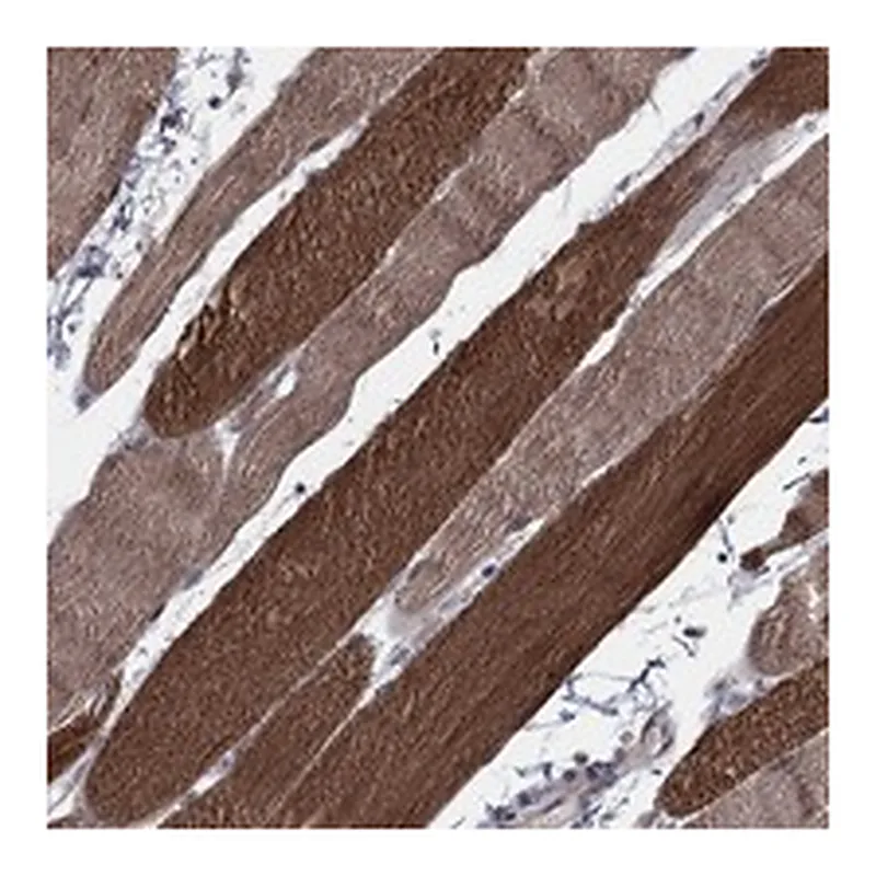 Atlas Antibodies Anti-PSMC1 Antibody