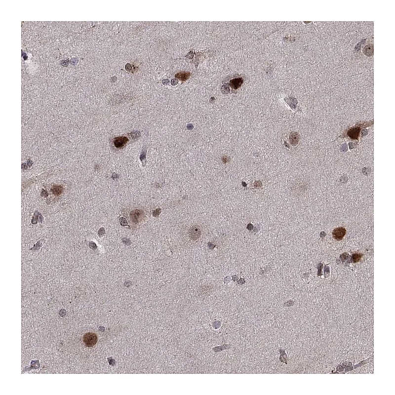 Atlas Antibodies Anti-PSMC2 Antibody