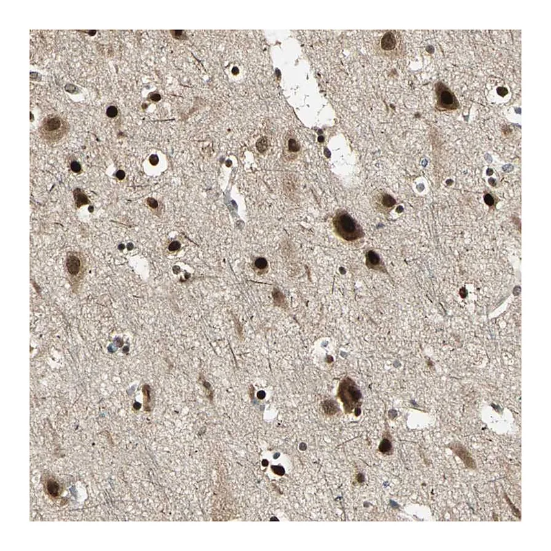 Atlas Antibodies Anti-PSMC3 Antibody