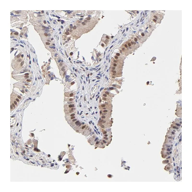 Atlas Antibodies Anti-PSMC4 Antibody