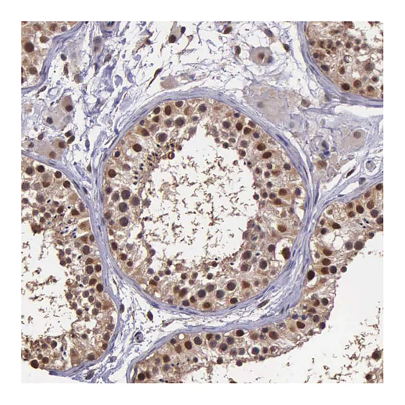 Atlas Antibodies Anti-PSMC1 Antibody