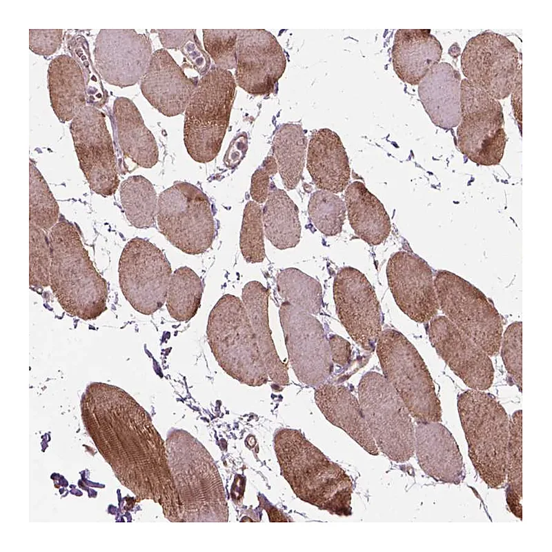 Atlas Antibodies Anti-PSMD11 Antibody