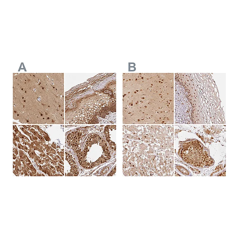 Atlas Antibodies Anti-PSMD1 Antibody