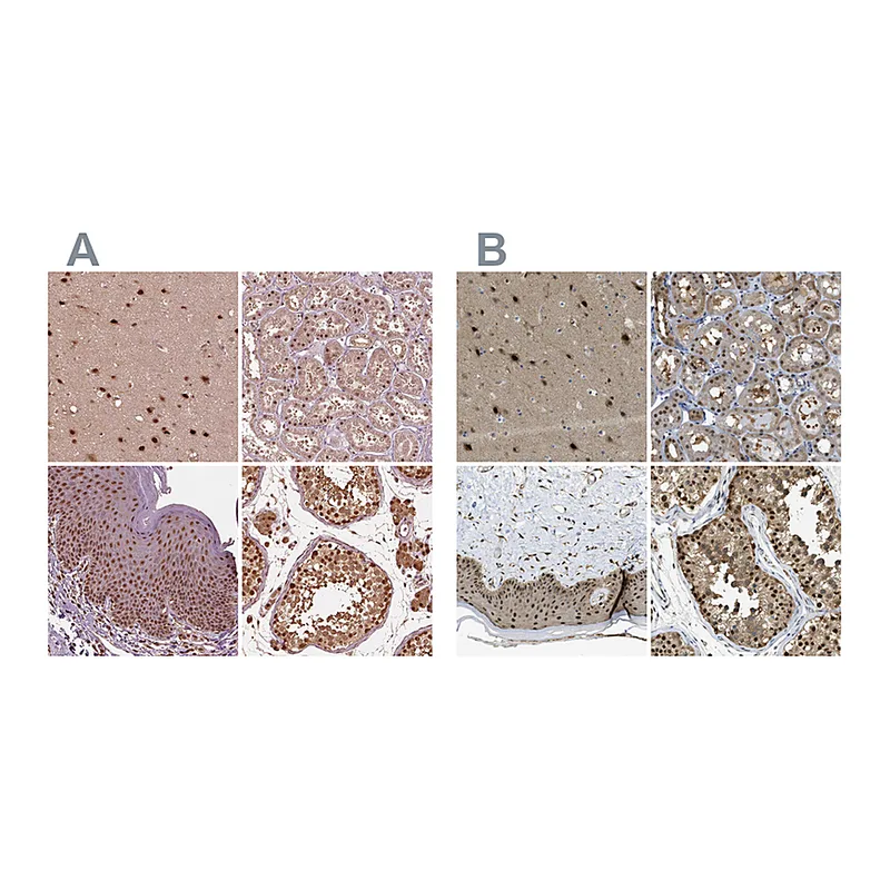 Atlas Antibodies Anti-PSMC5 Antibody