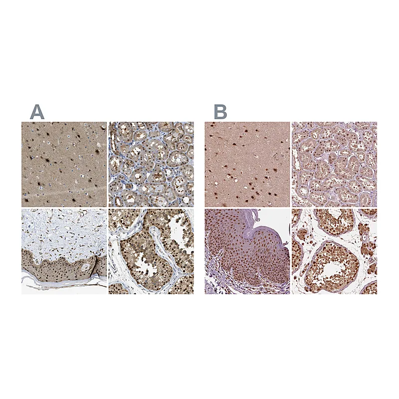 Atlas Antibodies Anti-PSMC5 Antibody